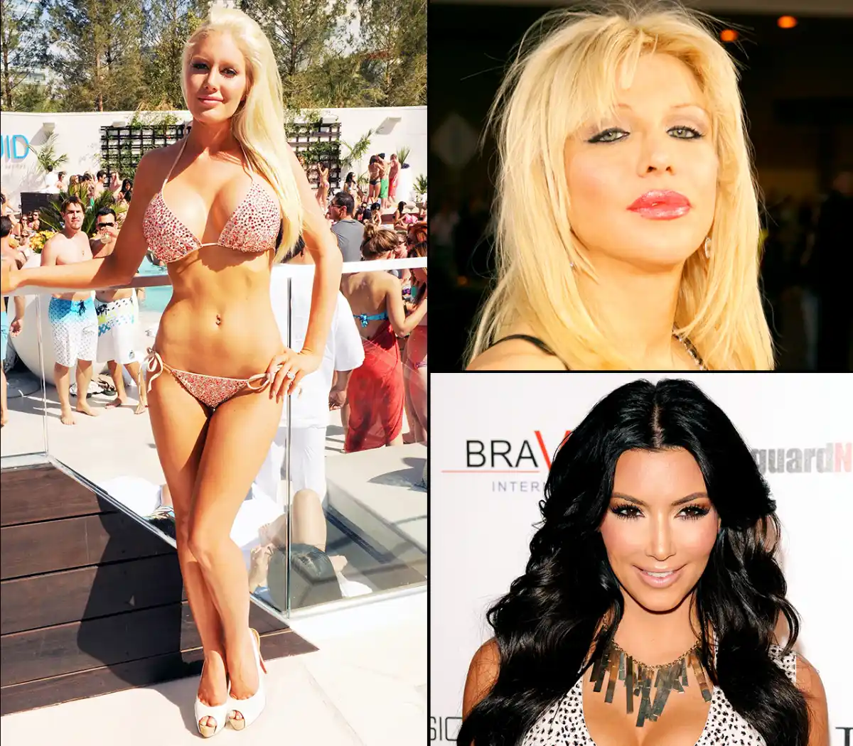 1400071402_plastic surgery nightmares zoom