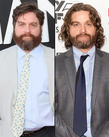 1413227430_zach galifianakis weight loss 441