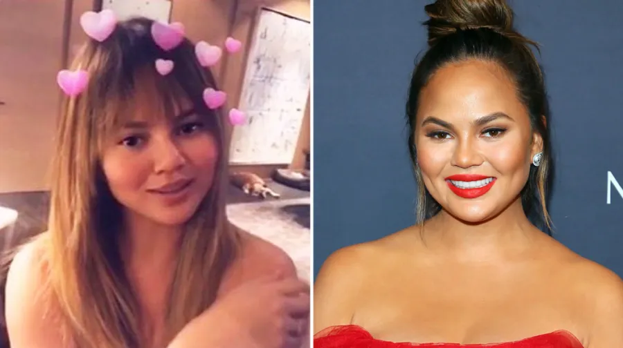 chrissy teigen