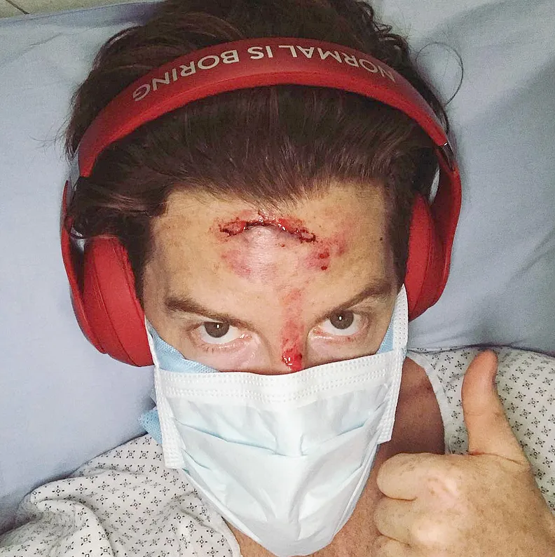 Shaun White Accident