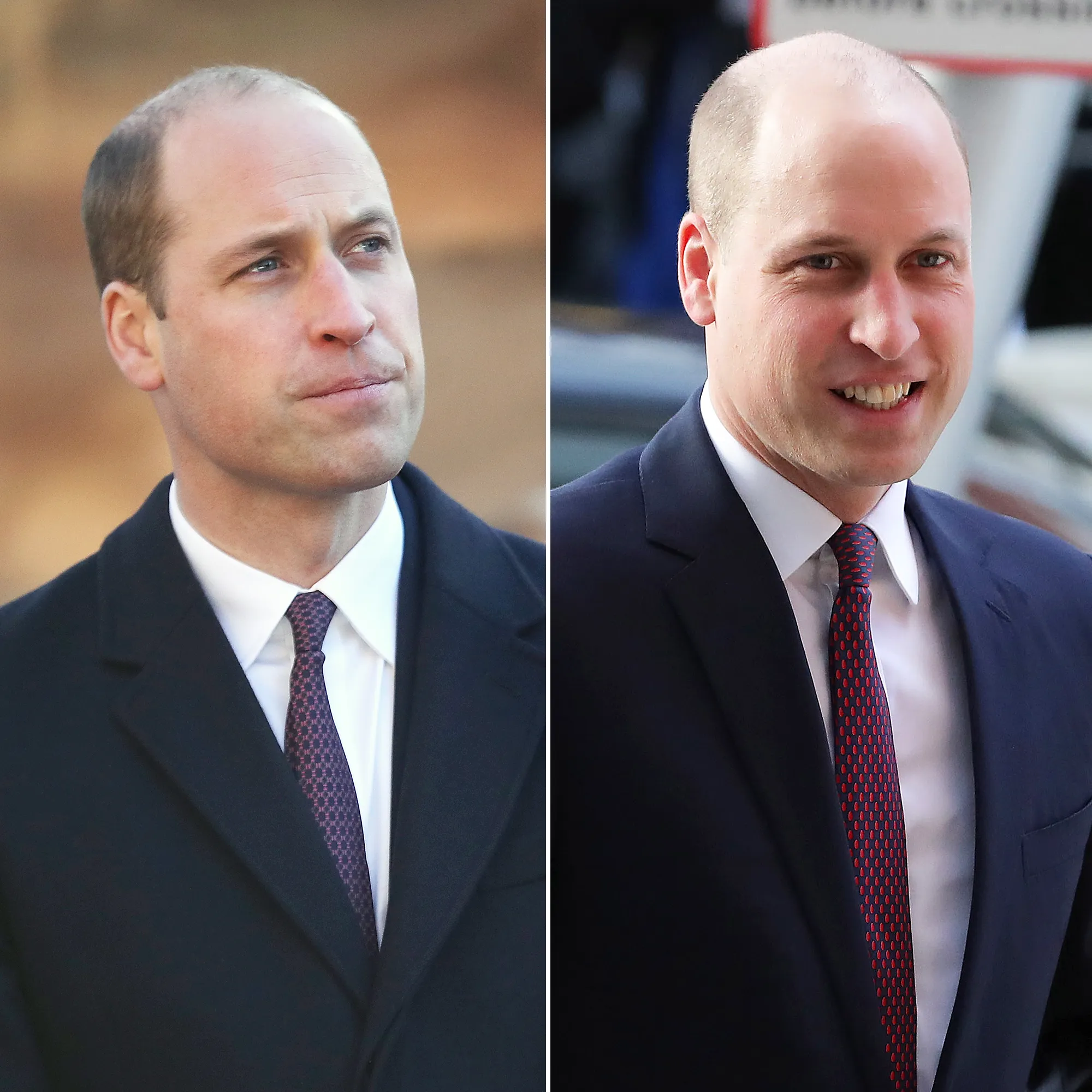 Prince William shaved head