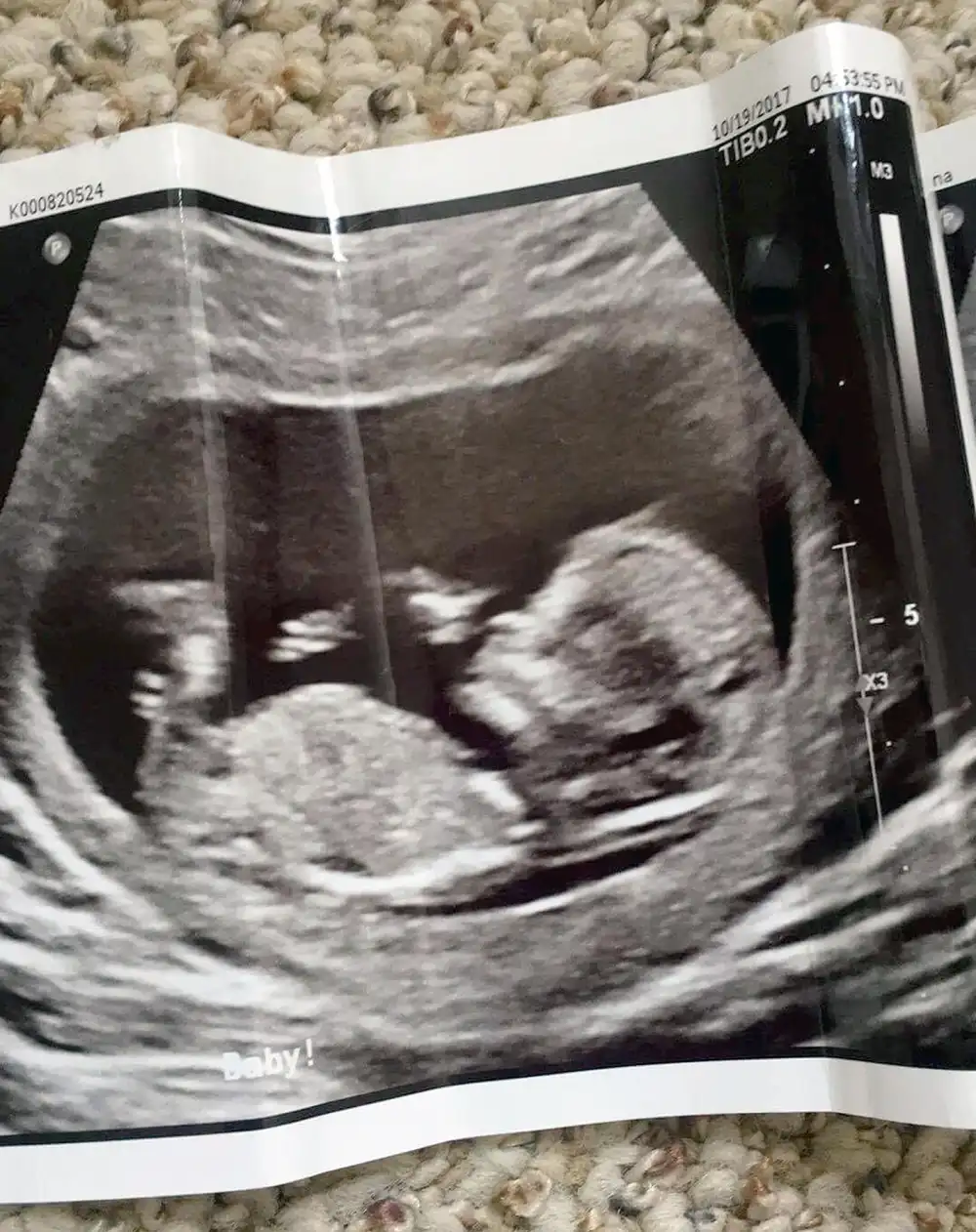 Reanna Stephens ultrasound