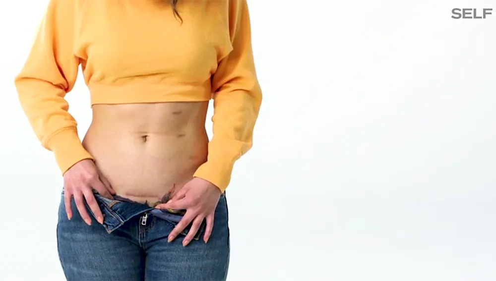 Francia Raisa's scar