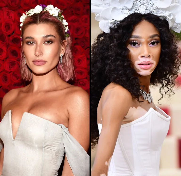 Hailey Baldwin and Winnie Harlow