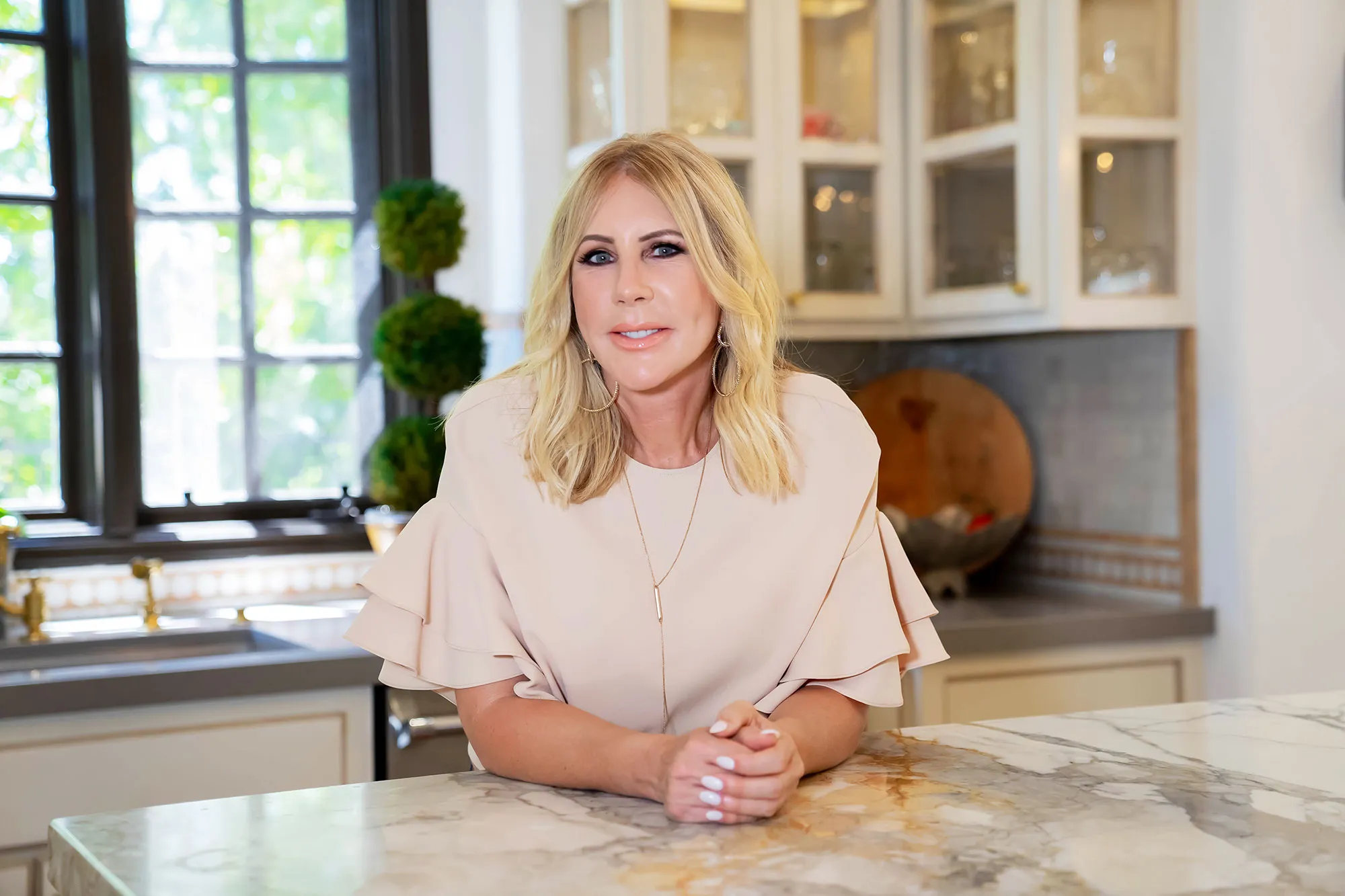 Vicki Gunvalson plastic surgery