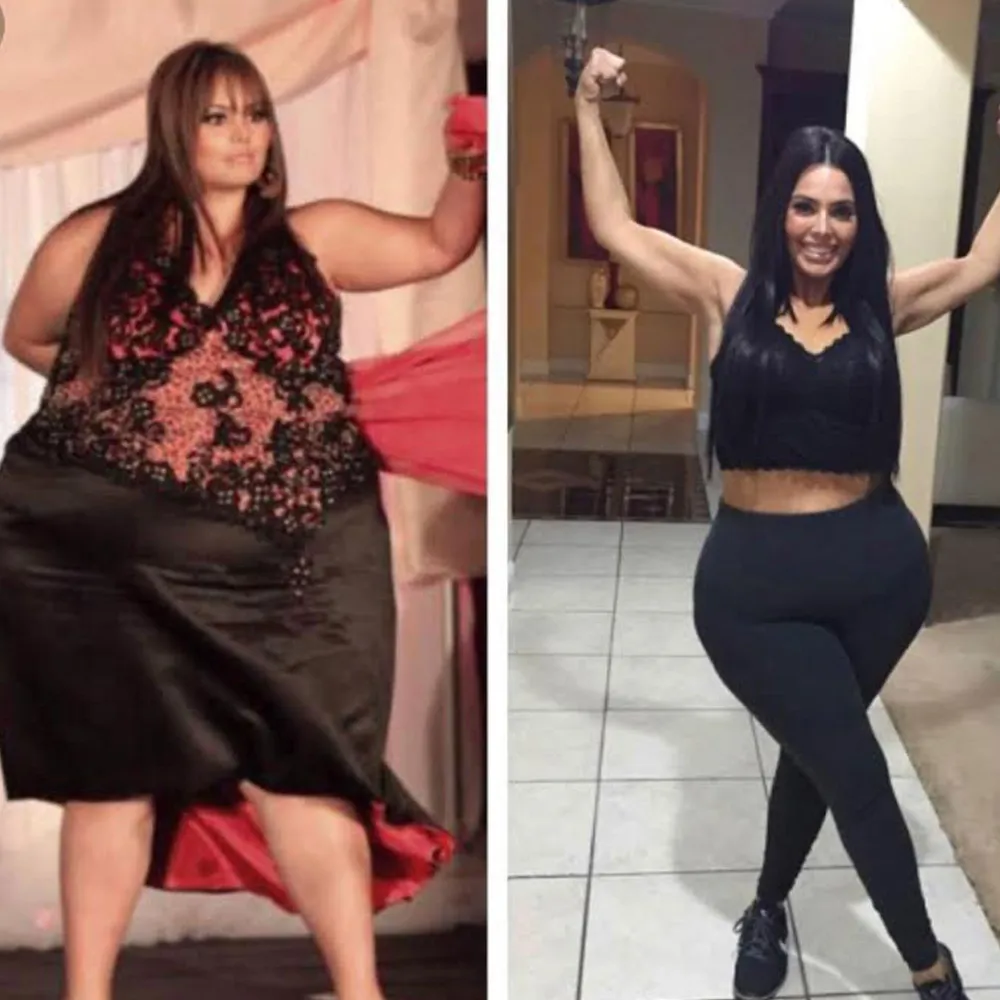 Roise Mercado 200 pound weight loss