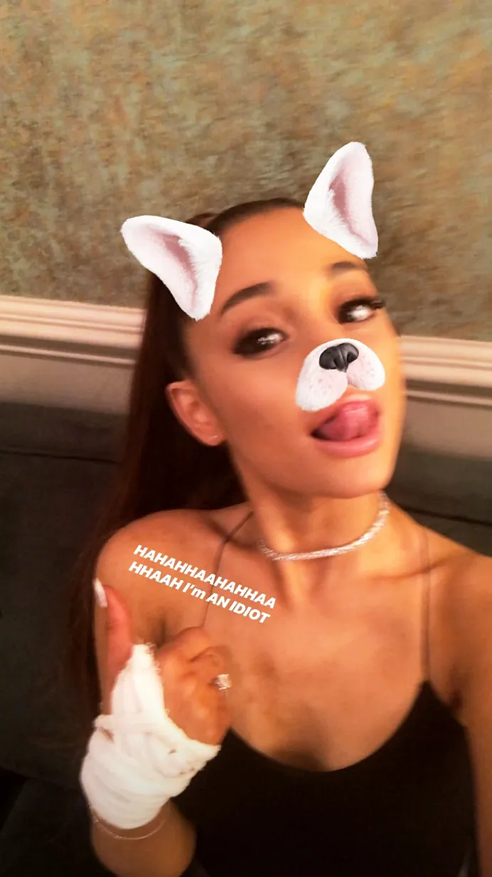 Ariana Grande Injury Carpool Karaoke