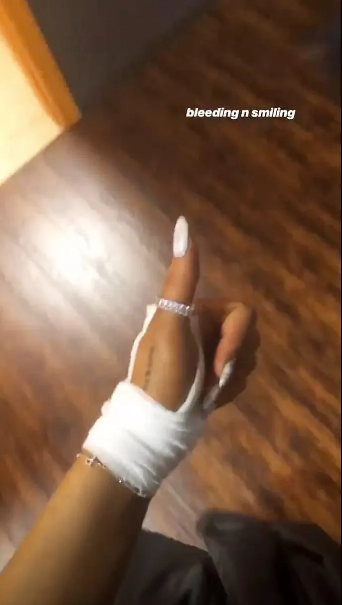 Ariana Grande Injury Carpool Karaoke