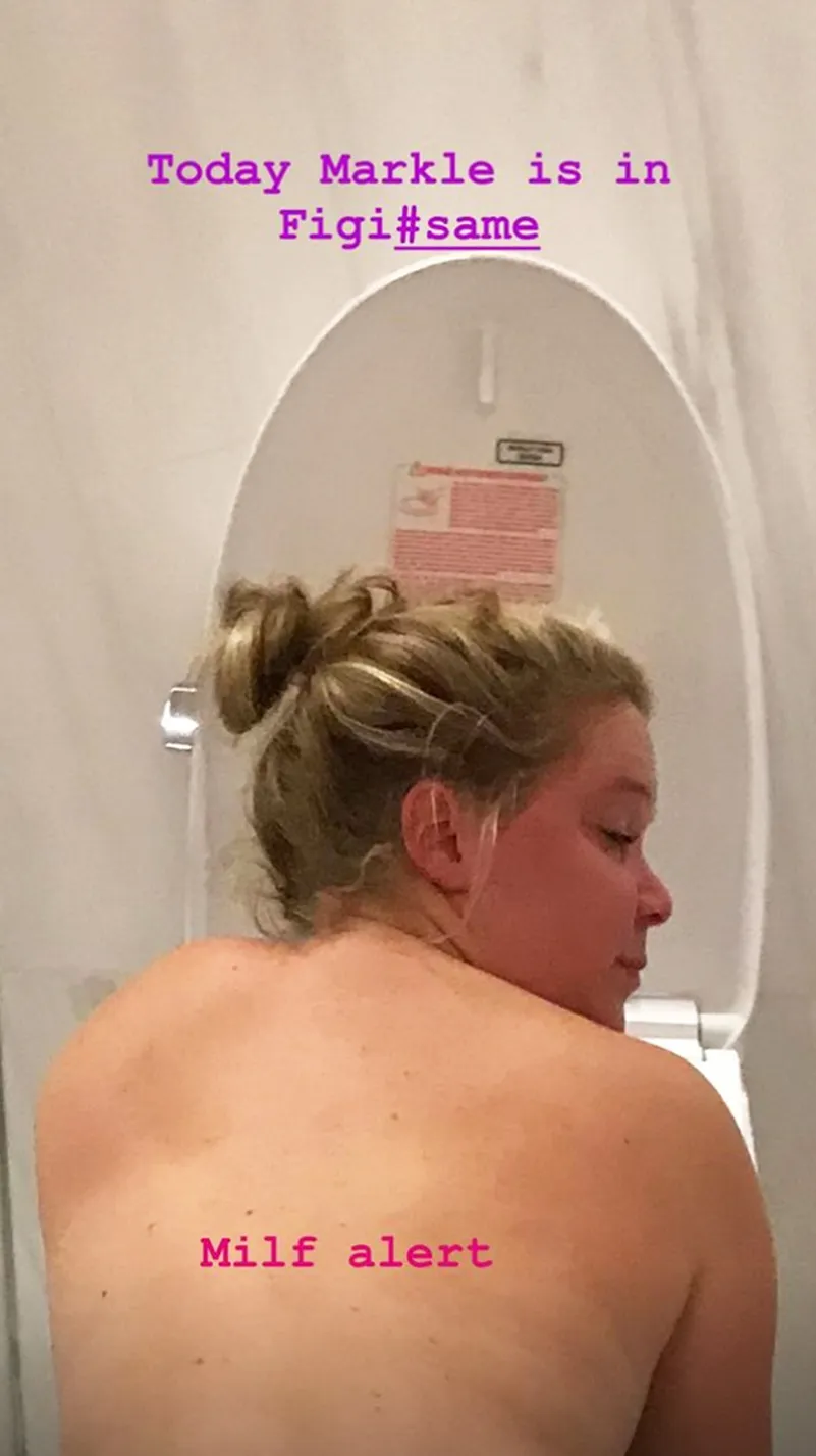 Amy Schumer Morning Sickness Pregnant Duchess Meghan