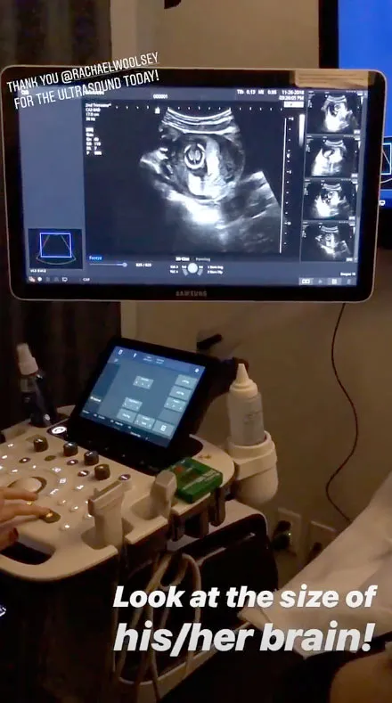 The Bachelor's Arie and Lauren Reveal Pregnancy Detail During Sonogram