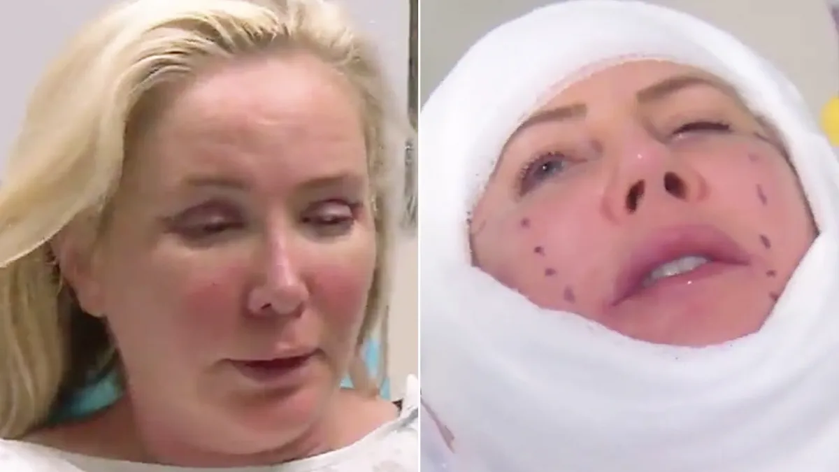 Shannon Beador Vicki Gunvalson Surgery