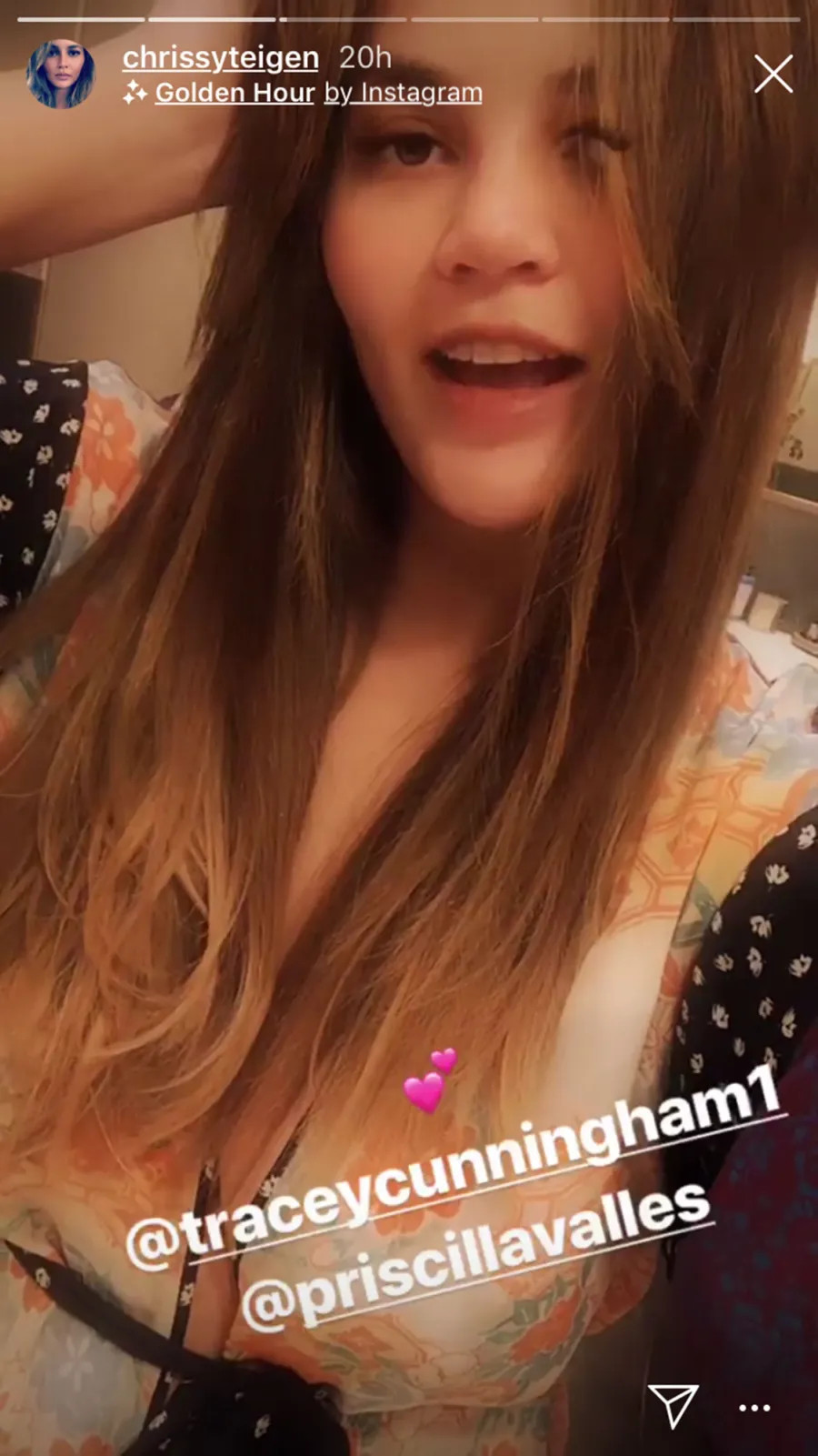 Chrissy Teigen