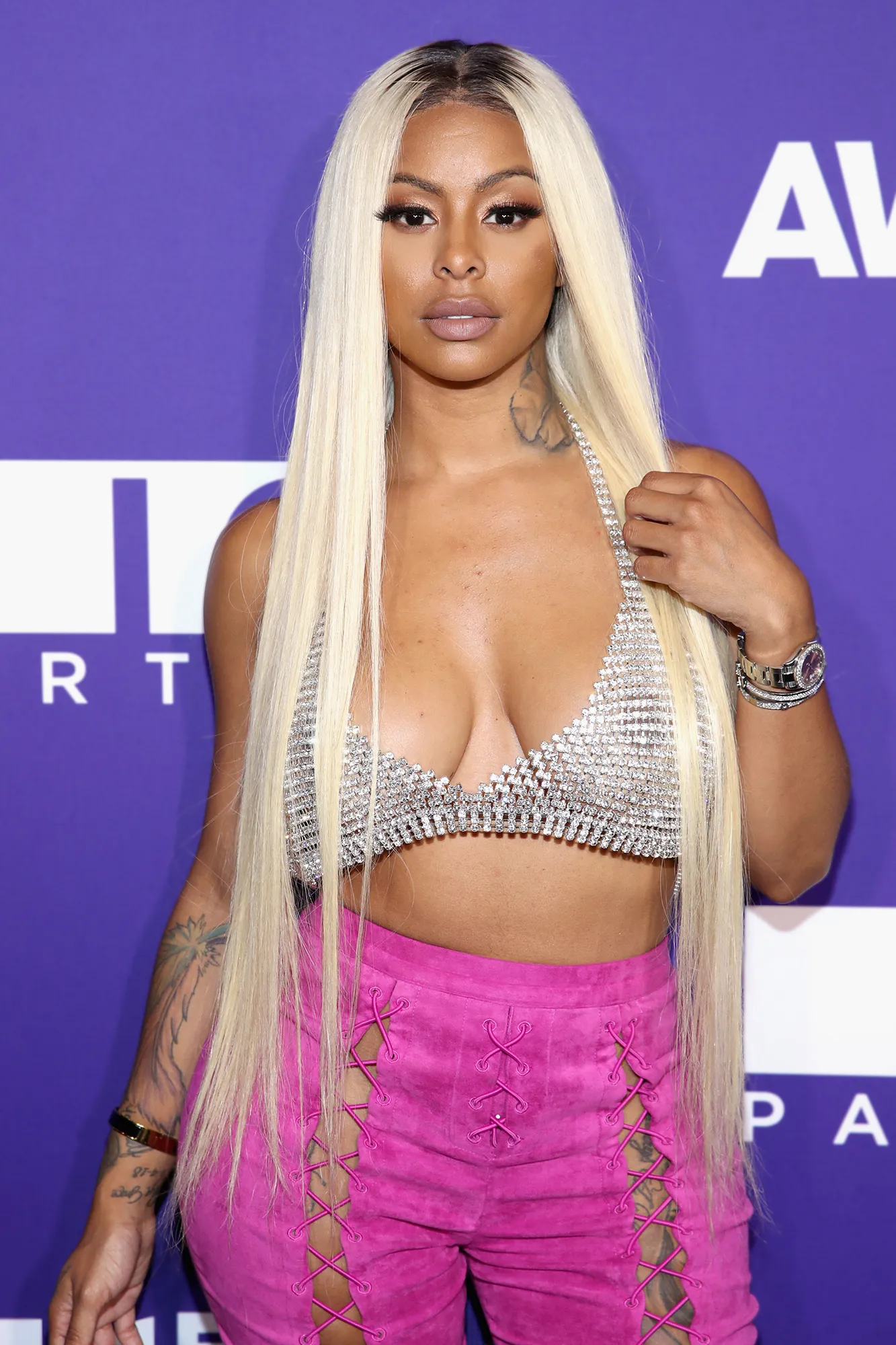 Alexis Skyy’s Baby Undergoes Surgery: ‘Prayers Please’
