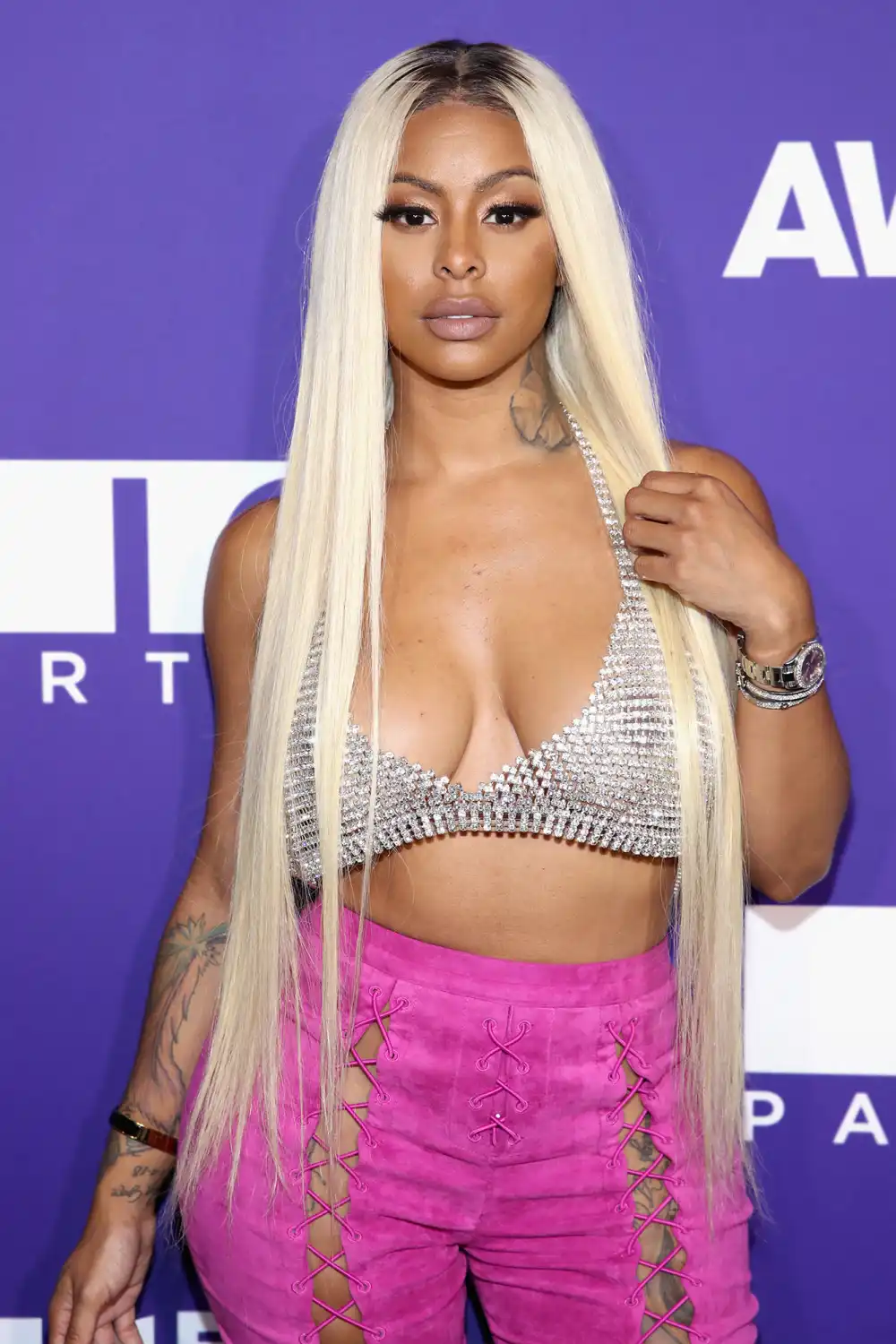 Alexis Skyy&rsquo;s Baby Undergoes Surgery: &lsquo;Prayers Please&rsquo;