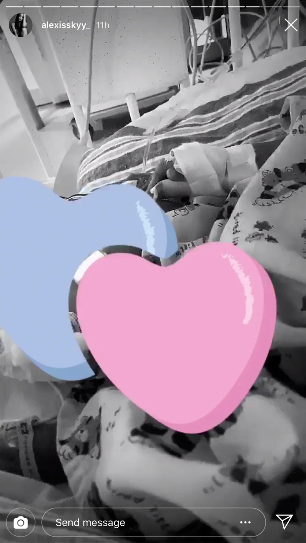 Alexis Skyy&rsquo;s Baby Undergoes Surgery: &lsquo;Prayers Please&rsquo;