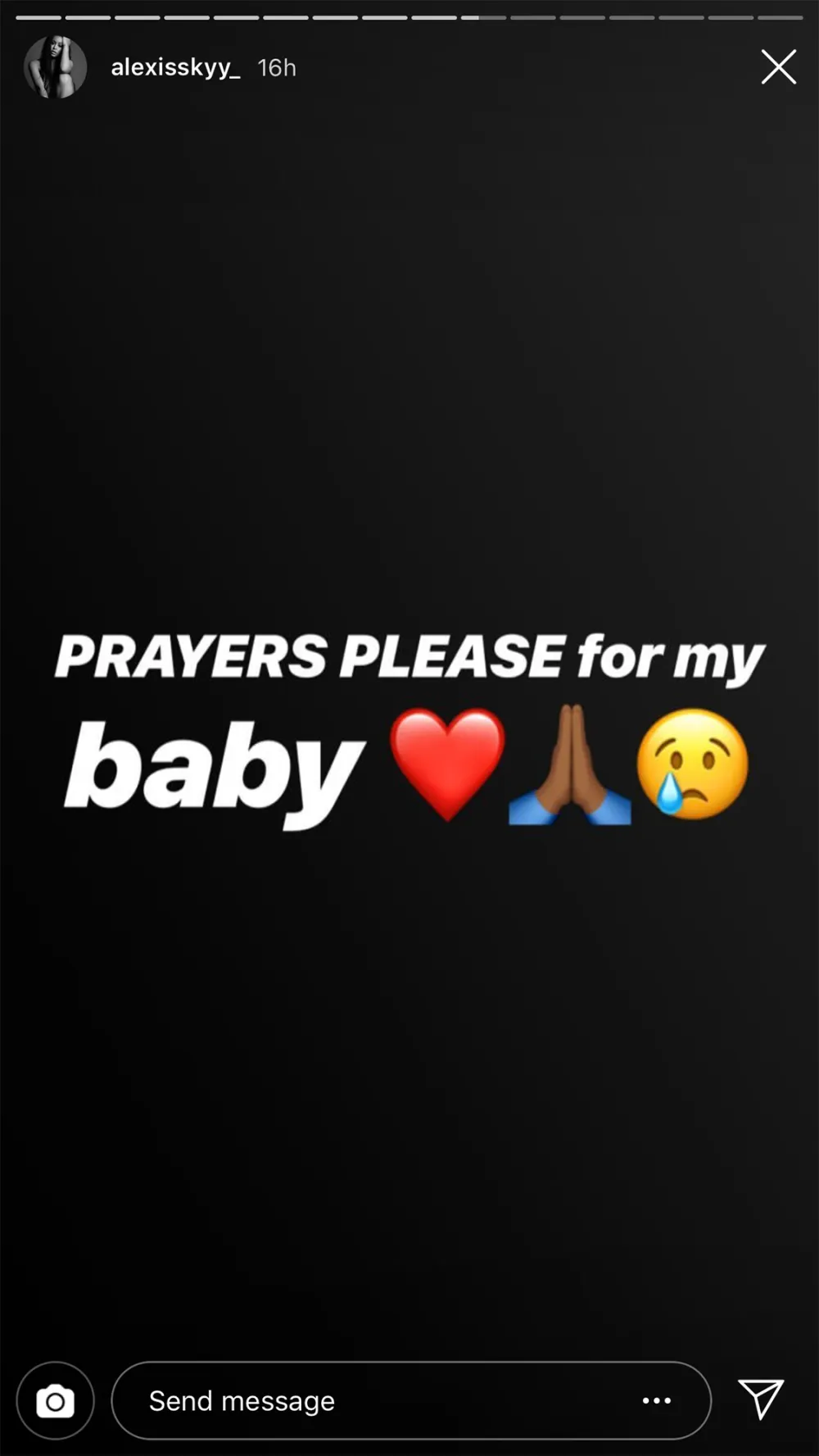 Alexis Skyy&rsquo;s Baby Undergoes Surgery: &lsquo;Prayers Please&rsquo;