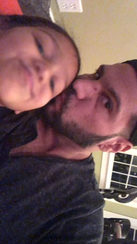 Ronnie-Ortiz-Magro -Reveals-Facial Injuries-After-Jen Harley-Fight