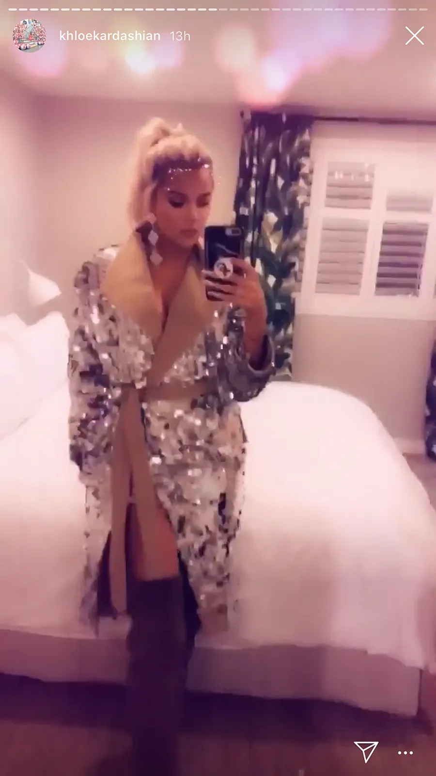 Stars Without Pants: See Which Celebs Are Showing Off Their Legs in Pantless Outfits