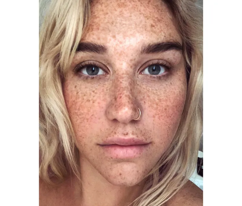 kesha-freckles-no-makeup