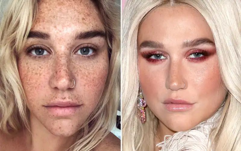 kesha-no-makeup-vs-makeup
