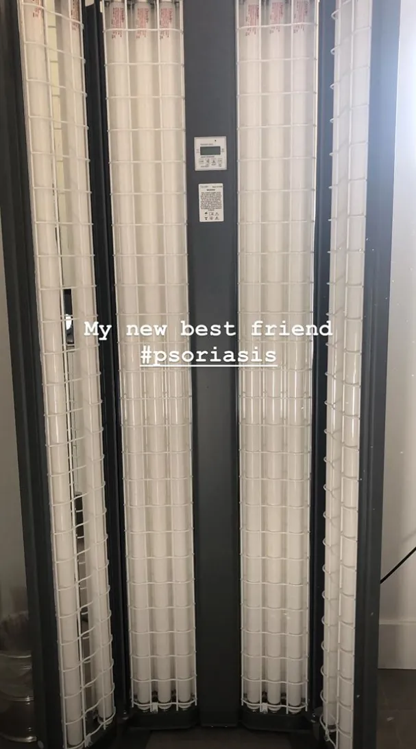 Kim-Kardashian-Psoriasis