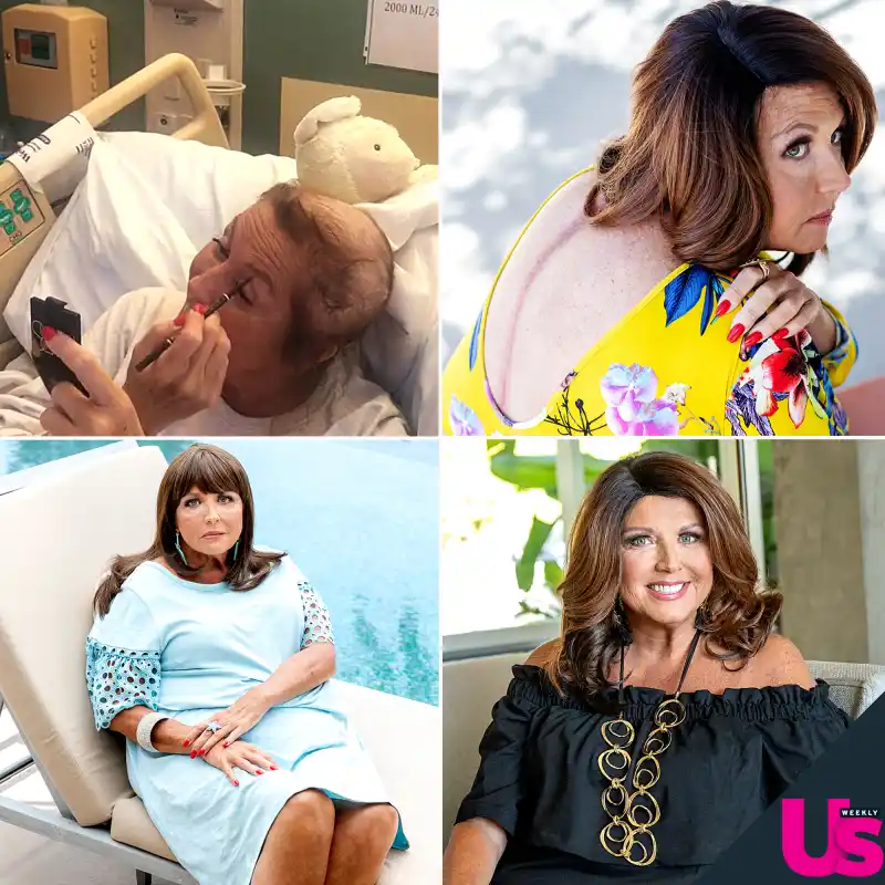 Abby Lee Miller Shows Off Her Scars Amid Cancer Battle