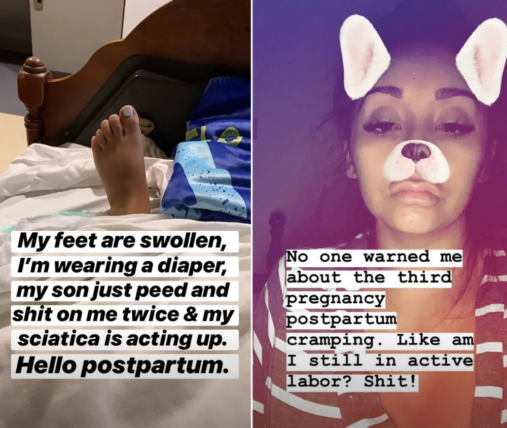 Nicole-Snooki-Polizzi-Postpartum-Symptoms