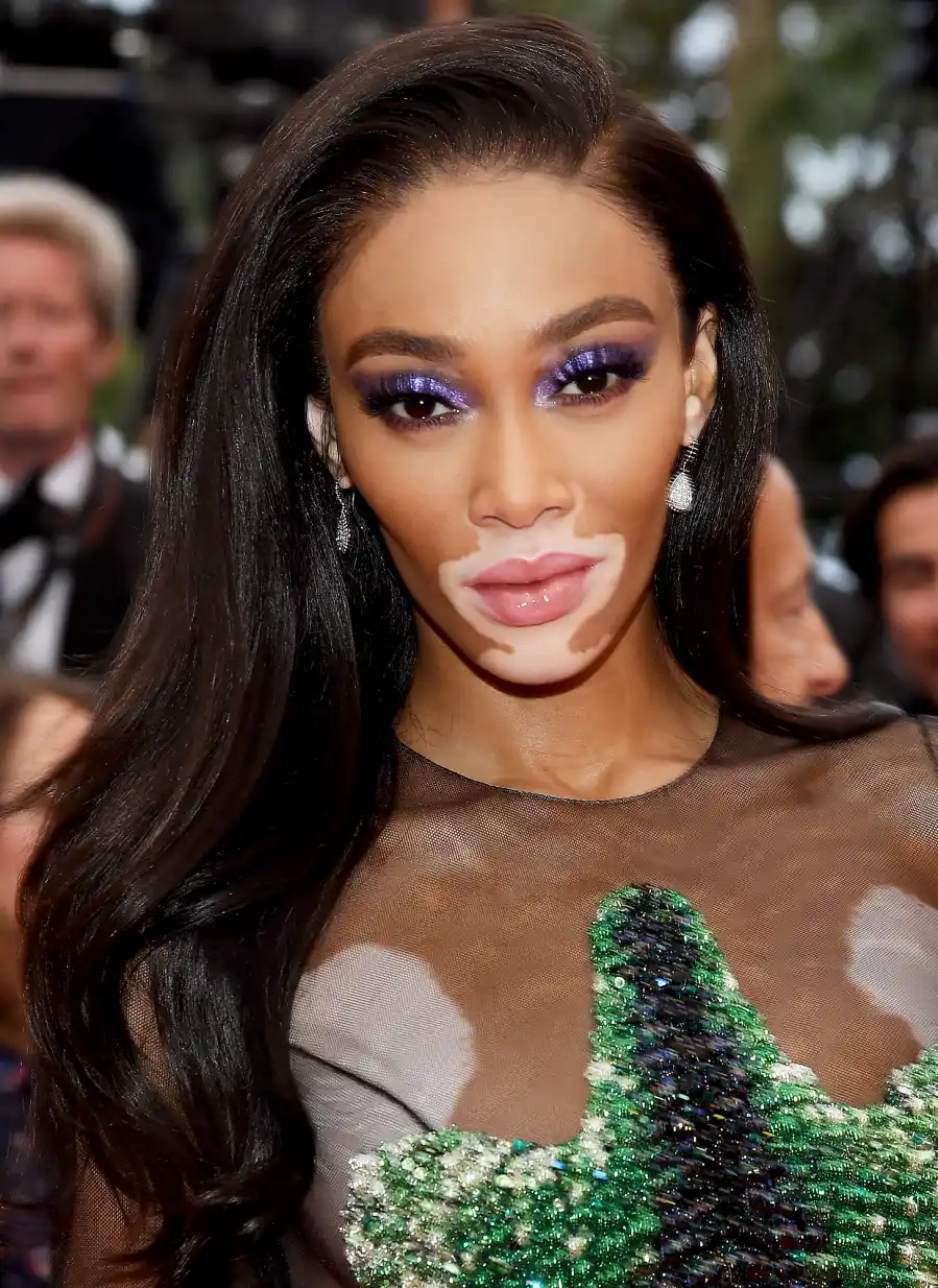 Winnie-Harlow