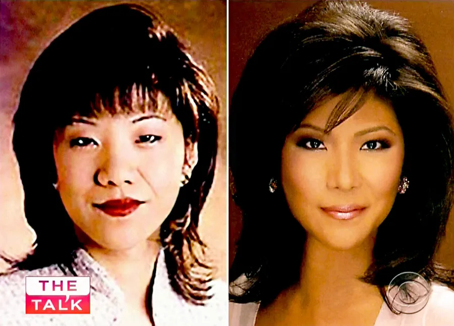 plastic surgery celebs before after