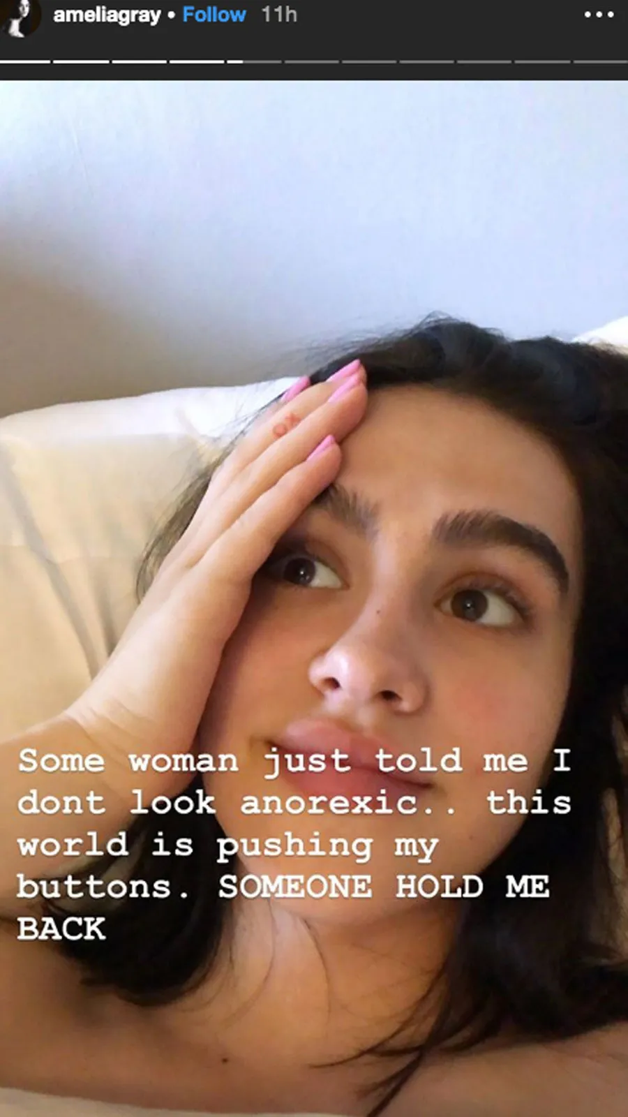 Lisa Rinna&rsquo;s Daughter Amelia Hamlin Gets Real About Her Anorexia Battle-2