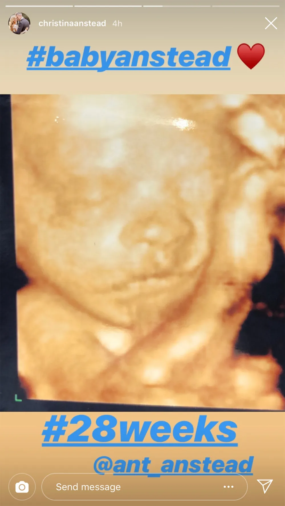 Pregnant Christina Anstead Shares Sonogram