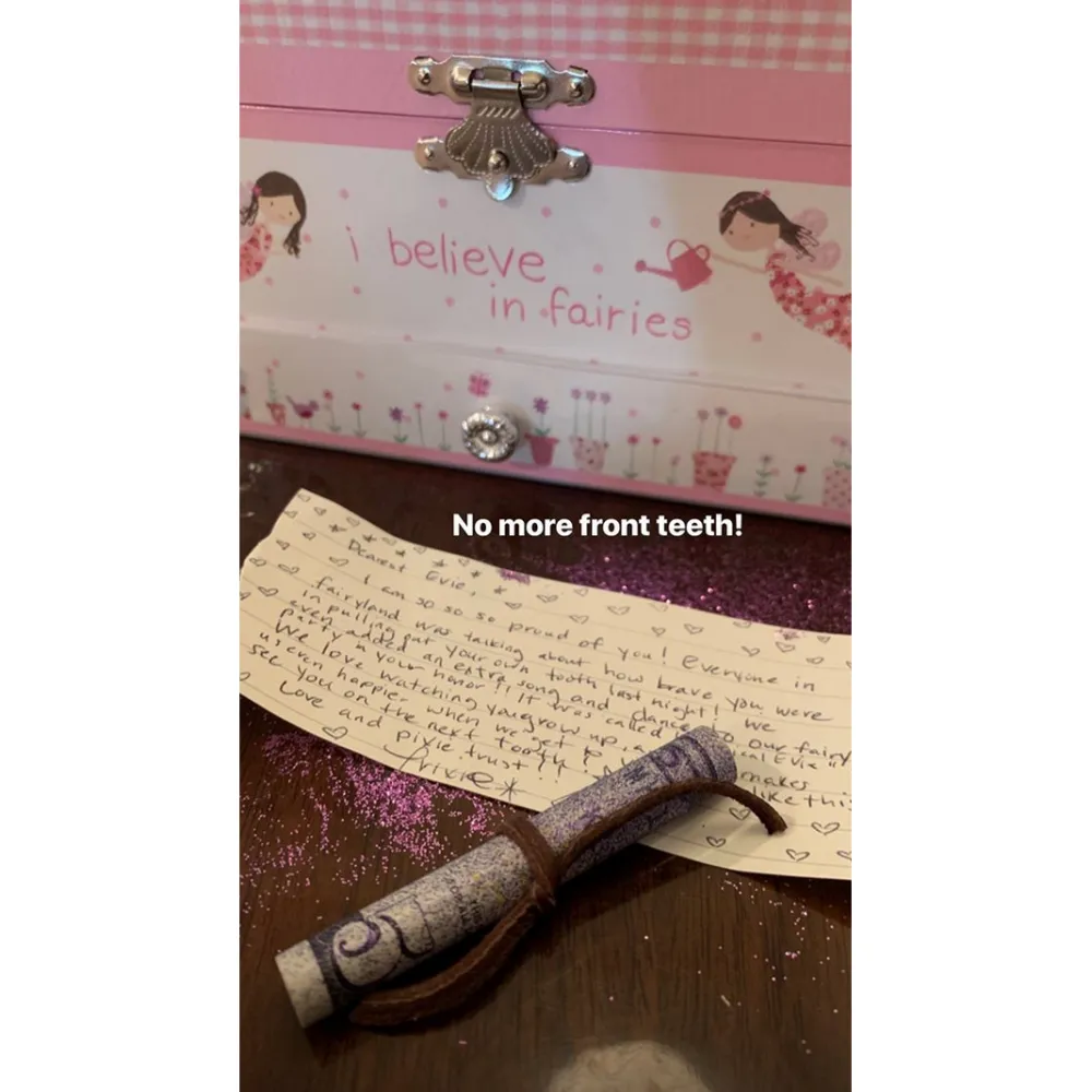 Jenna-Dewan-and-Channing-Tatum-daughter-loses-front-teeth