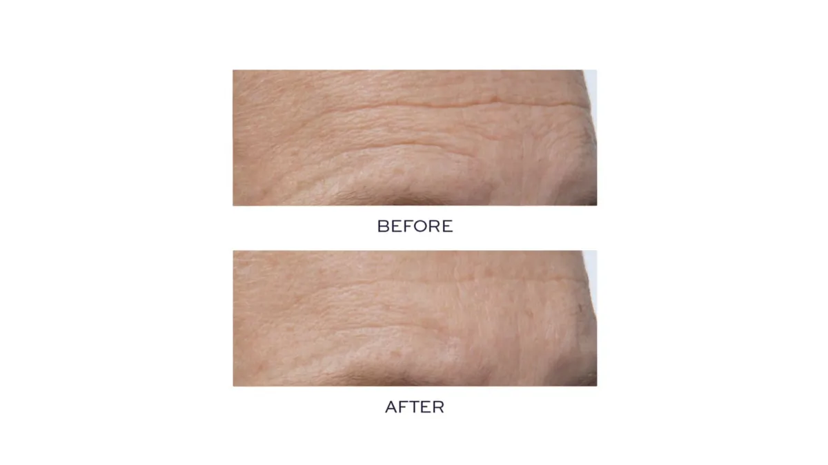 Before-and-After-Serum-Nordstrom