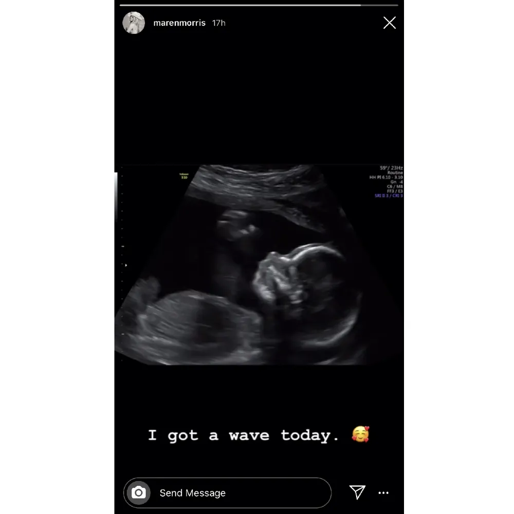 Pregnant Maren Morris Gets &lsquo;a Wave&rsquo; From Baby Boy in Sonogram Video