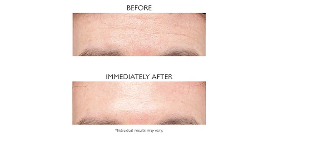 Peter Thomas Roth Instant FIRMx Eye