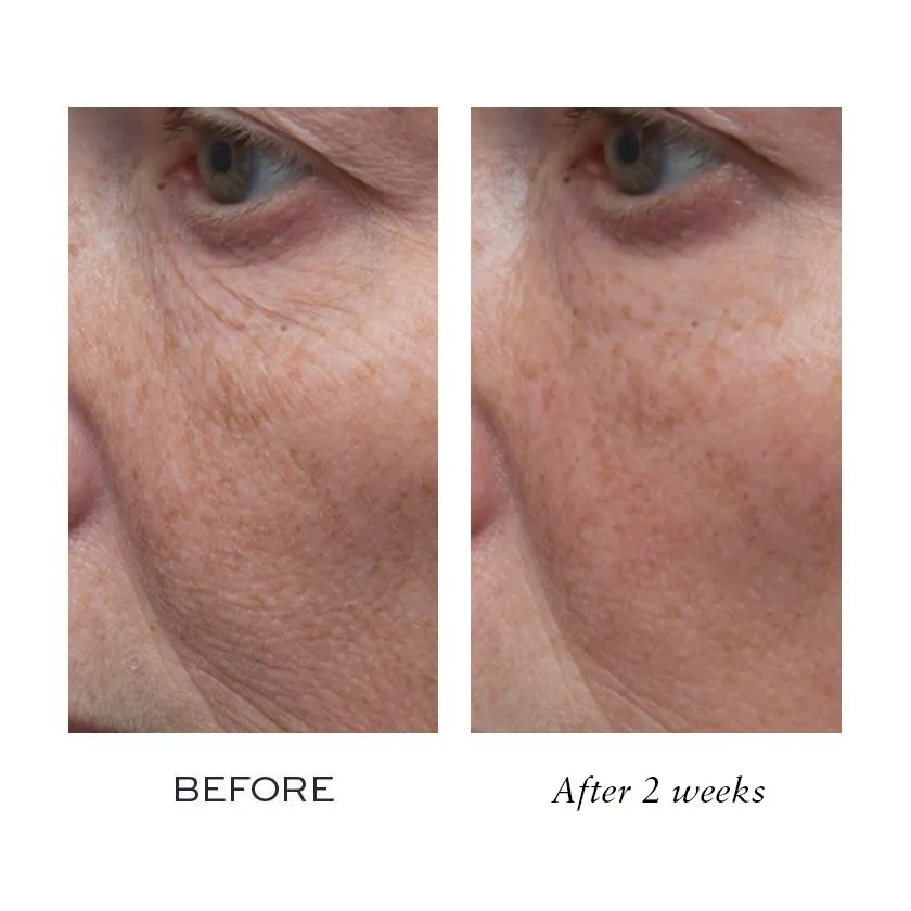 Elemis Black Friday Deal