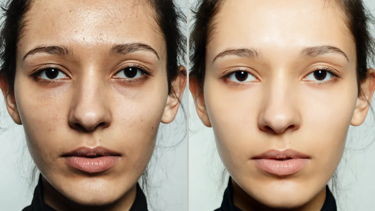 Before and After Skincare Black Friday