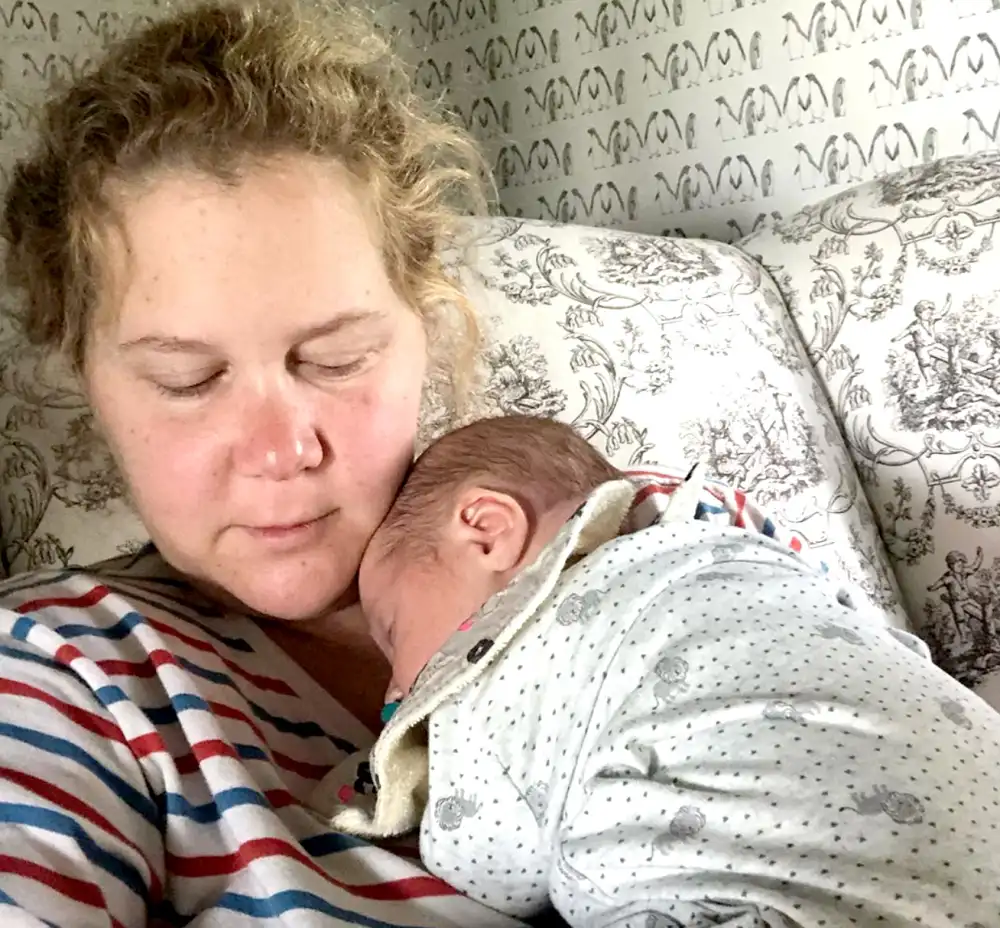 Amy Schumer&rsquo;s &lsquo;Really Scary&rsquo; C-Section Took 3 Hours