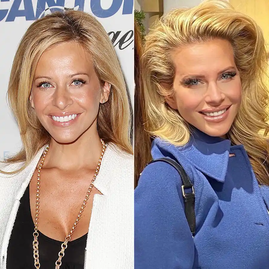 Celebs Who Admitted They Got Plastic Surgery