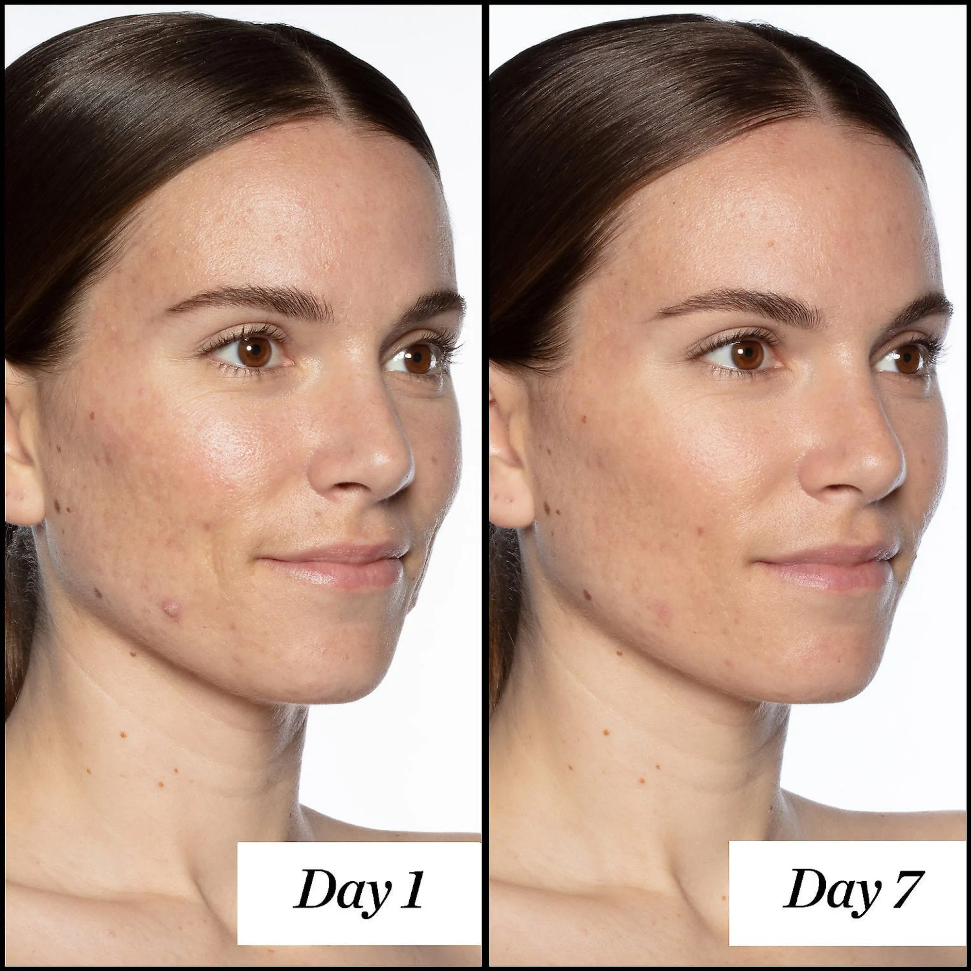 Sunday Riley Good Genes Serum Before and After