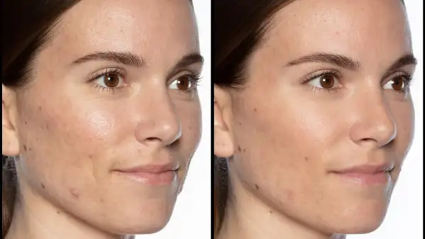 Sunday Riley Good Genes Serum Before and After