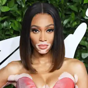 Winnie Harlow's Styling Tips