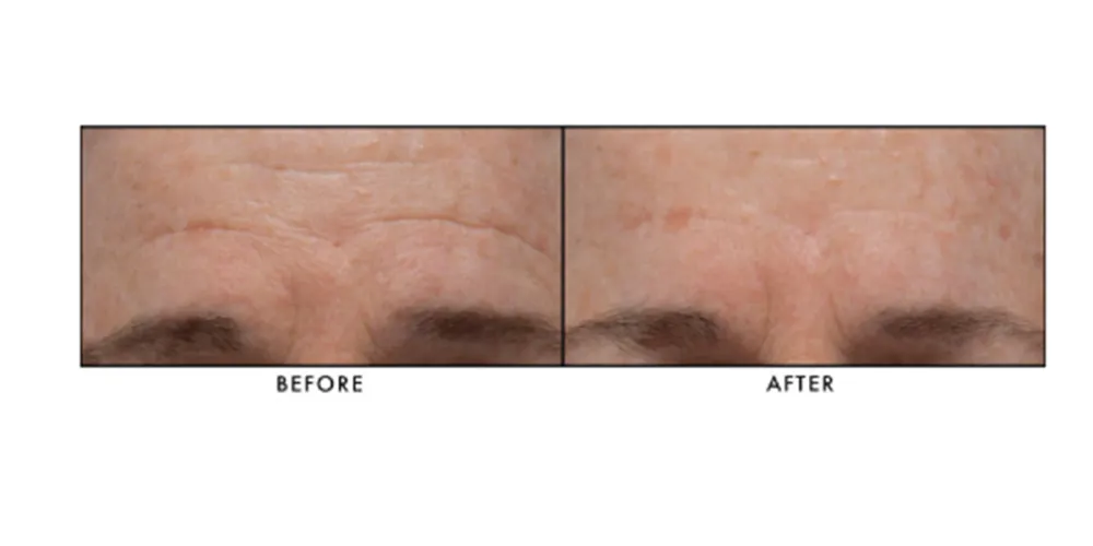 Lancer Skincare The Method: Normal-Combination Skin, 3-Piece Kit