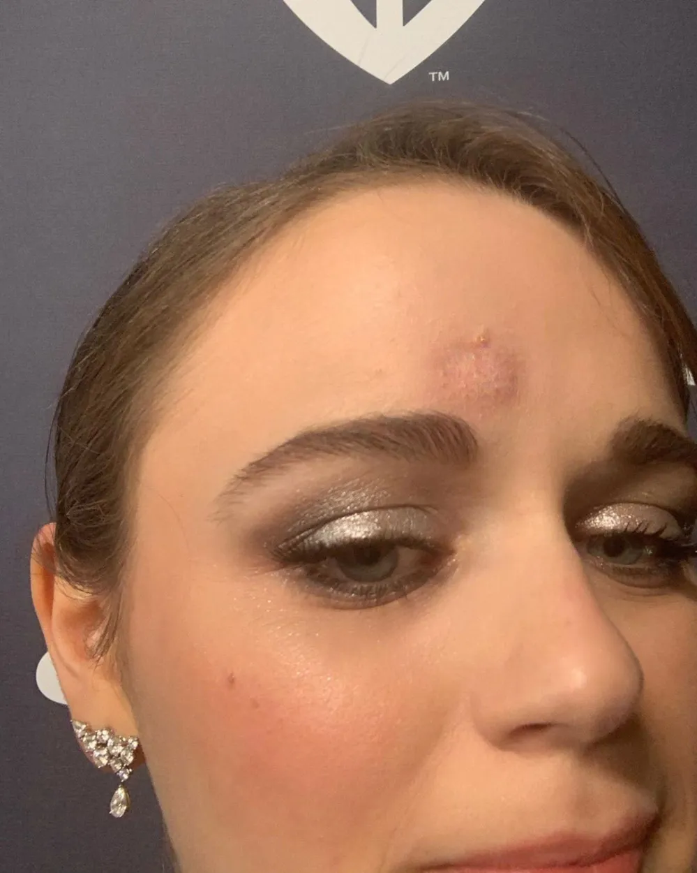 Joey King Hit In Head By Patricia Arquette At Golden Globe SAG Awards 2020 Instagram
