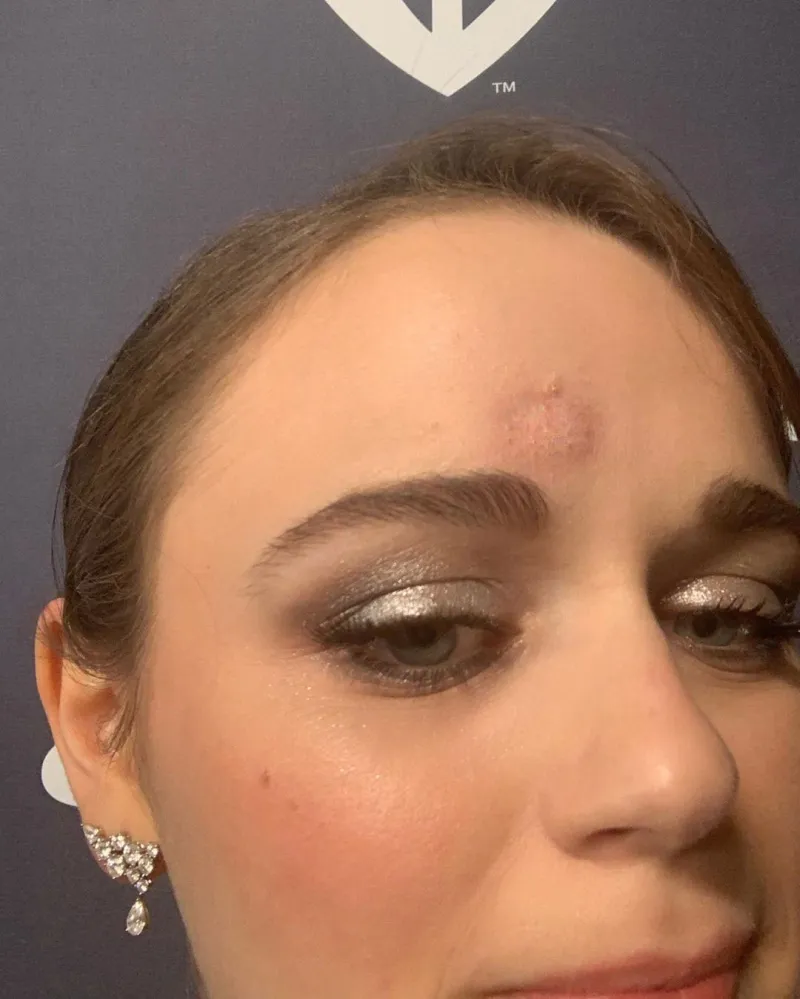 Joey King Hit In Head By Patricia Arquette At Golden Globe SAG Awards 2020 Instagram