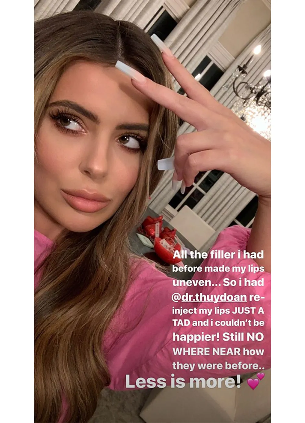 Brielle Biermann Lip Fillers Selfie Instagram