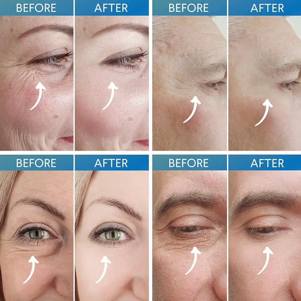 Evagloss Rapid Reduction Eye Cream