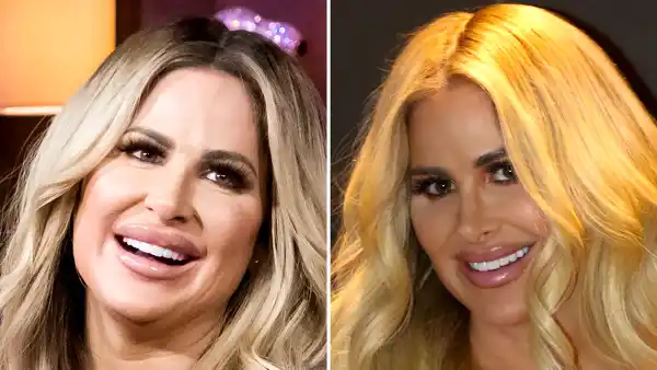 Kim Zolciak Didn't Feel Like Myself Before Dissolving My Lips