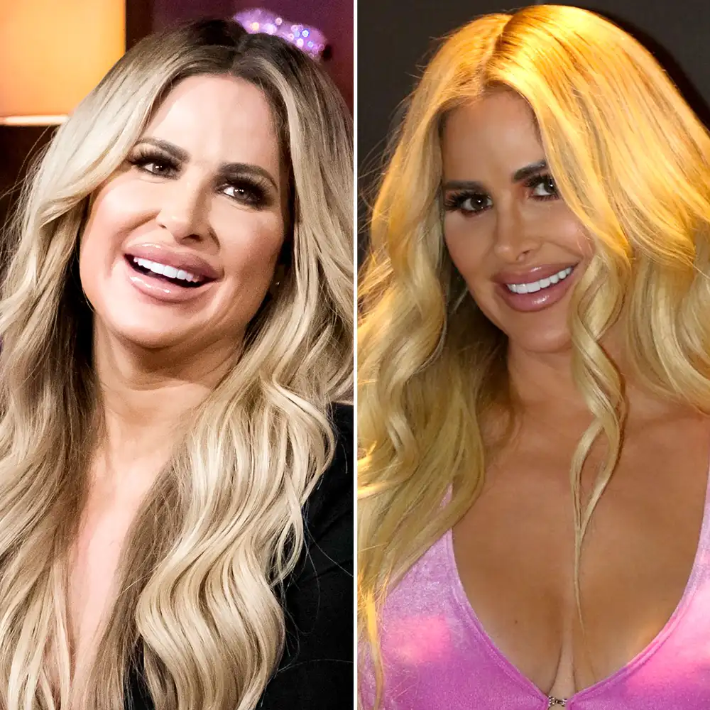 Kim Zolciak Didn't Feel Like Myself Before Dissolving My Lips