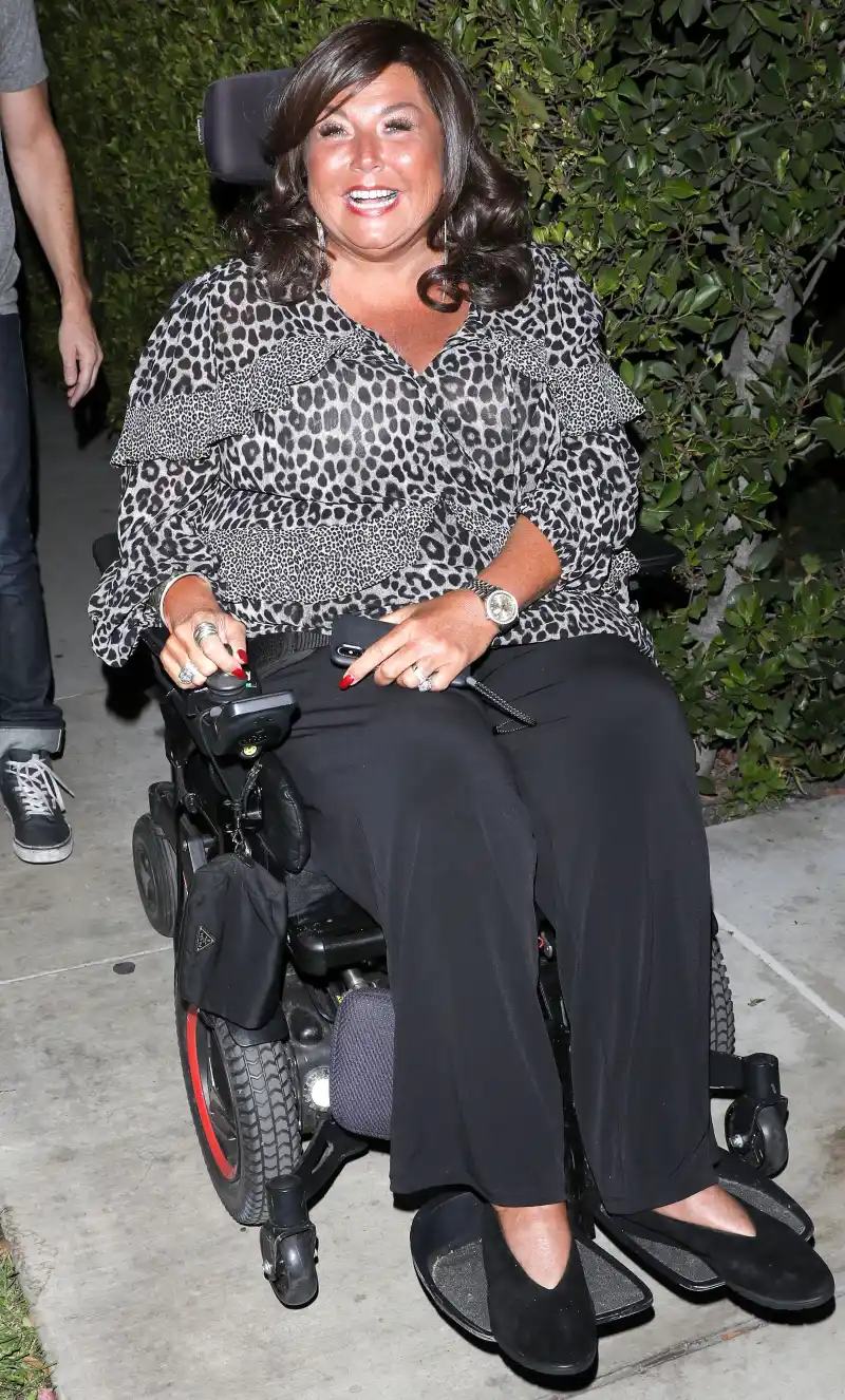 Abby Lee Miller Reveals Facelift Results See Before After Photos